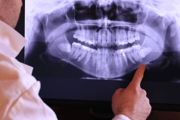Best Broken Tooth Emergency  in Kings Mills, OH
