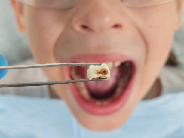 Best Tooth Infection Emergency Dentist  in Kings Mills, OH